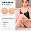 IPL Hair Removal Device for Women & Men with Ice-Cooling, Painless At-Home Laser Hair Remover for Full Body & Bikini, Rose Gold - 3 of 4