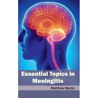 Essential Topics in Meningitis - by  Matthew Martin (Hardcover)