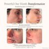 LightAura Plus | LED Face & Neck Mask by Project E Beauty | 7 Colors Light Therapy | Anti-aging | Anti-Acne | Skin Rejuvenation | Home Skin Care Mask - 3 of 4