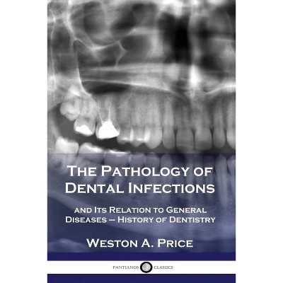 The Pathology of Dental Infections - by  Weston a Price (Paperback)