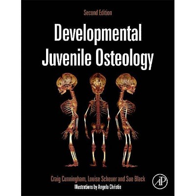 Developmental Juvenile Osteology - 2nd Edition by  Craig Cunningham & Louise Scheuer & Sue Black (Hardcover)