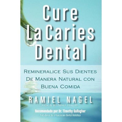 Cure La Caries Dental - by  Ramiel Nagel (Paperback)