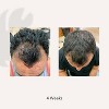 ACTiiV Hair Science Recover Shampoo & Conditioning System for Men (2.7 oz Duo Starter Kit) - Treatment for Hair Loss & Thinning Hair. Travel Size - 3 of 3