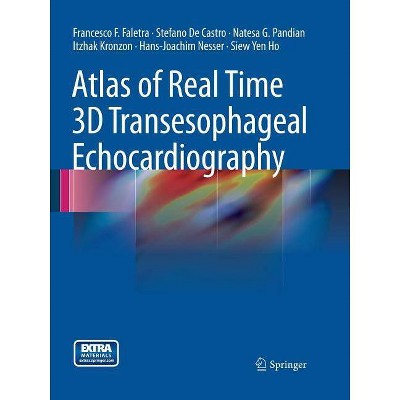 Atlas of Real Time 3D Transesophageal Echocardiography - (Paperback)