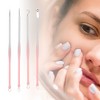Unique Bargains Full Moon Pimple Extractor Kit 1 Set - 4 of 4