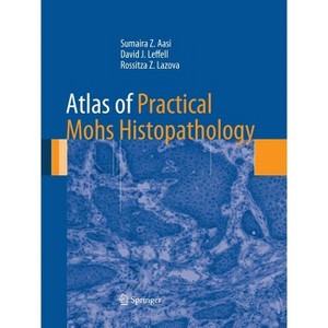Atlas of Practical Mohs Histopathology - by  Sumaira Z Aasi & David J Leffell & Rossitza Z Lazova (Paperback) - 1 of 1