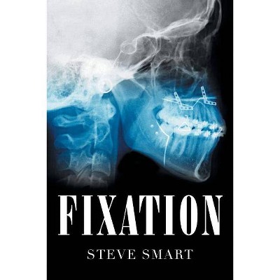 Fixation - by  Steve Smart (Paperback)