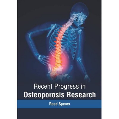 Recent Progress in Osteoporosis Research - by  Reed Spears (Hardcover)