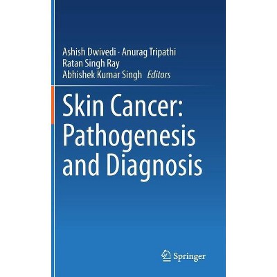 Skin Cancer: Pathogenesis and Diagnosis - by  Ashish Dwivedi & Anurag Tripathi & Ratan Singh Ray & Abhishek Kumar Singh (Hardcover)