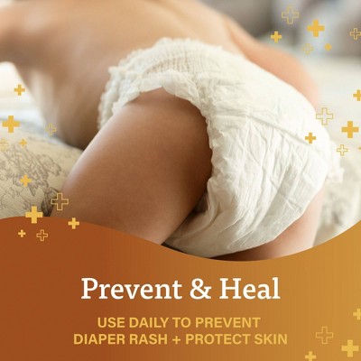 A + D Baby Diaper Rash Ointment, Baby Protectant with Vitamins A and D - 4oz, 5 of 15