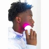 reVive Light Therapy Soniqué Mini Acne LED Sonic Cleanser - 2 of 4