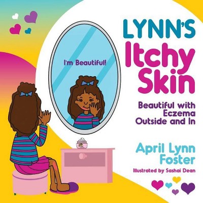 Lynn's Itchy Skin - by  April Lynn Foster (Paperback)