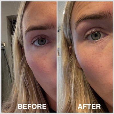 Guest review image 1 of 1, zoom in