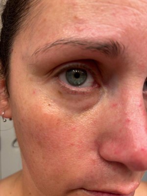 Guest review image 2 of 2, zoom in