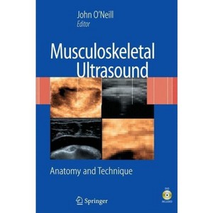 Musculoskeletal Ultrasound - by  John M D O'Neill (Mixed Media Product) - 1 of 1