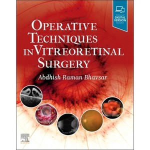 Operative Techniques in Vitreoretinal Surgery - by  Abdhish R Bhavsar (Hardcover) - 1 of 1