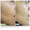 Urban Skin Rx Fade + Clarify Acne and Dark Spot Essentials Kit - 3ct - 3 of 4