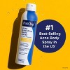 PanOxyl Acne Banishing Body Spray 2% Salicylic Acid - 6oz - 4 of 4