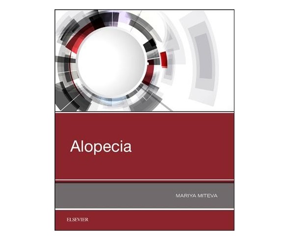 Alopecia -  1 by M.D.  Mariya Miteva (Paperback)