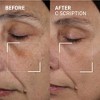 Dr. Brandt Bright This Way C Scription - Concentrated Vitamin C Serum - 3 of 4