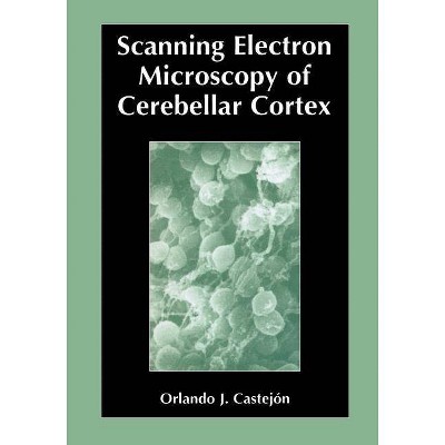 Scanning Electron Microscopy of Cerebellar Cortex - by  Orlando Castejon (Paperback)