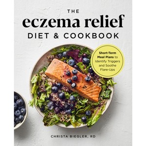 The Eczema Relief Diet & Cookbook - by  Christa Biegler (Paperback) - 1 of 1