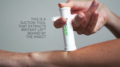 Bug Bite Thing Suction Tool - Home of The Humble Warrior