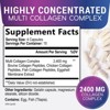 Collagen Peptides for Women & Men - Hydrolyzed Supplement for Skin Bone Support - 60 Capsules By Nature's Peak - 2 of 4