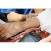 Dealmed Padded Aluminum Splint, Reusable Waterproof Splint, 4.25" x 36", Orange (Pack of 1) - 2 of 4