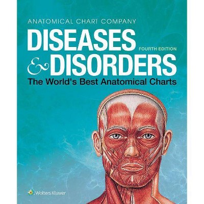  Diseases & Disorders - (World's Best Anatomical Chart) 4th Edition,Annotated by  Adele Webb (Spiral Bound) 