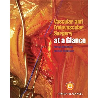 Vascular and Endovascular Surgery at a Glance - (At a Glance) by  Morgan McMonagle & Matthew Stephenson (Paperback)