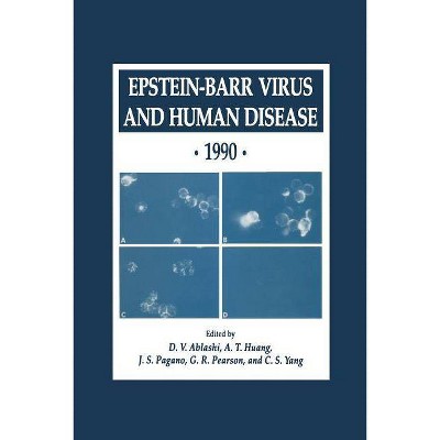 Epstein-Barr Virus and Human Disease - 1990 - (Experimental Biology and Medicine) by  D V Ablashi & A T Huang & J S Pagano & G R Pearson & C S Yang