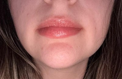 Guest review image 1 of 3, zoom in