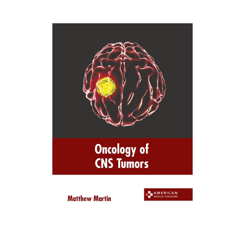 Oncology of CNS Tumors - by  Matthew Martin (Hardcover), 1 of 2