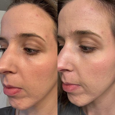 Guest review image 1 of 1, zoom in