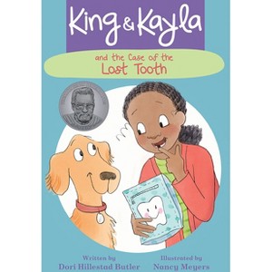 King & Kayla and the Case of the Lost Tooth - by  Dori Hillestad Butler (Paperback) - 1 of 1