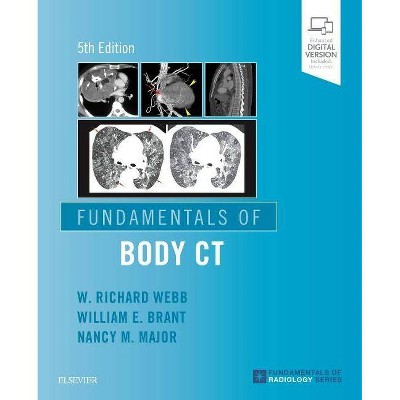 Fundamentals of Body CT - (Fundamentals of Radiology) 5th Edition by  W Richard Webb & Wiliam E Brant & Nancy M Major (Paperback)