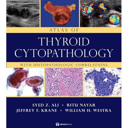 Atlas of Thyroid Cytopathology - by Syed Z Ali & Ritu Nayar & Jeffrey F  Krane & William H Westra (Hardcover)