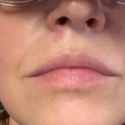 Guest review image 1 of 1, zoom in