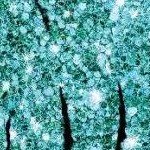 clear push pins bundle