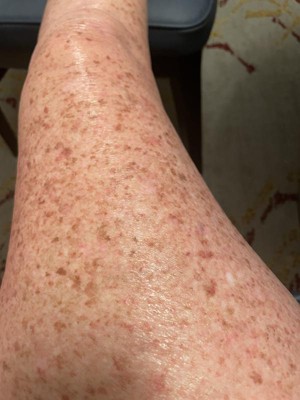 Guest review image 2 of 2, zoom in