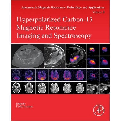 Hyperpolarized Carbon-13 Magnetic Resonance Imaging and Spectroscopy, 3 - (Advances in Magnetic Resonance Technology and Applications) (Paperback)
