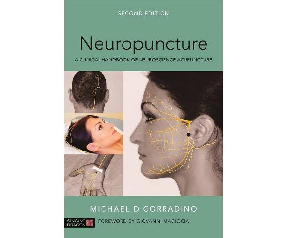 Neuropuncture - 2 Edition by  Michael Corradino (Paperback)