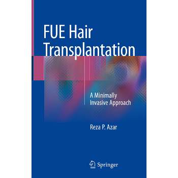Fue Hair Transplantation - by  Reza P Azar (Hardcover)