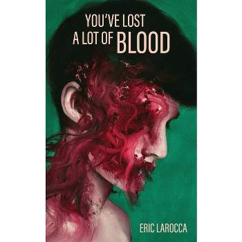 You've Lost a Lot of Blood - by  Eric Larocca (Paperback)