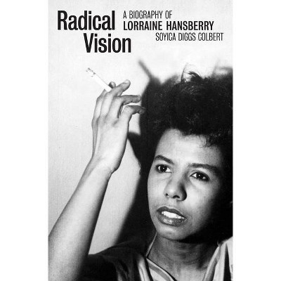 Radical Vision - by  Soyica Diggs Colbert (Hardcover)