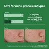 Mediheal Teatree Calming Hydra Serum - 1.35 oz - 4 of 4