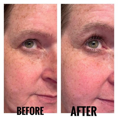 Guest review image 1 of 1, zoom in