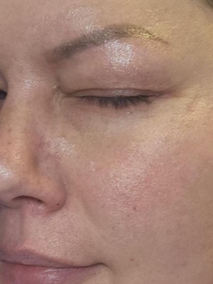 Guest review image 1 of 2, zoom in