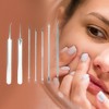 Unique Bargains Professional Pimple Extractor Tool Kit Silver Tone Set of 7 - 4 of 4